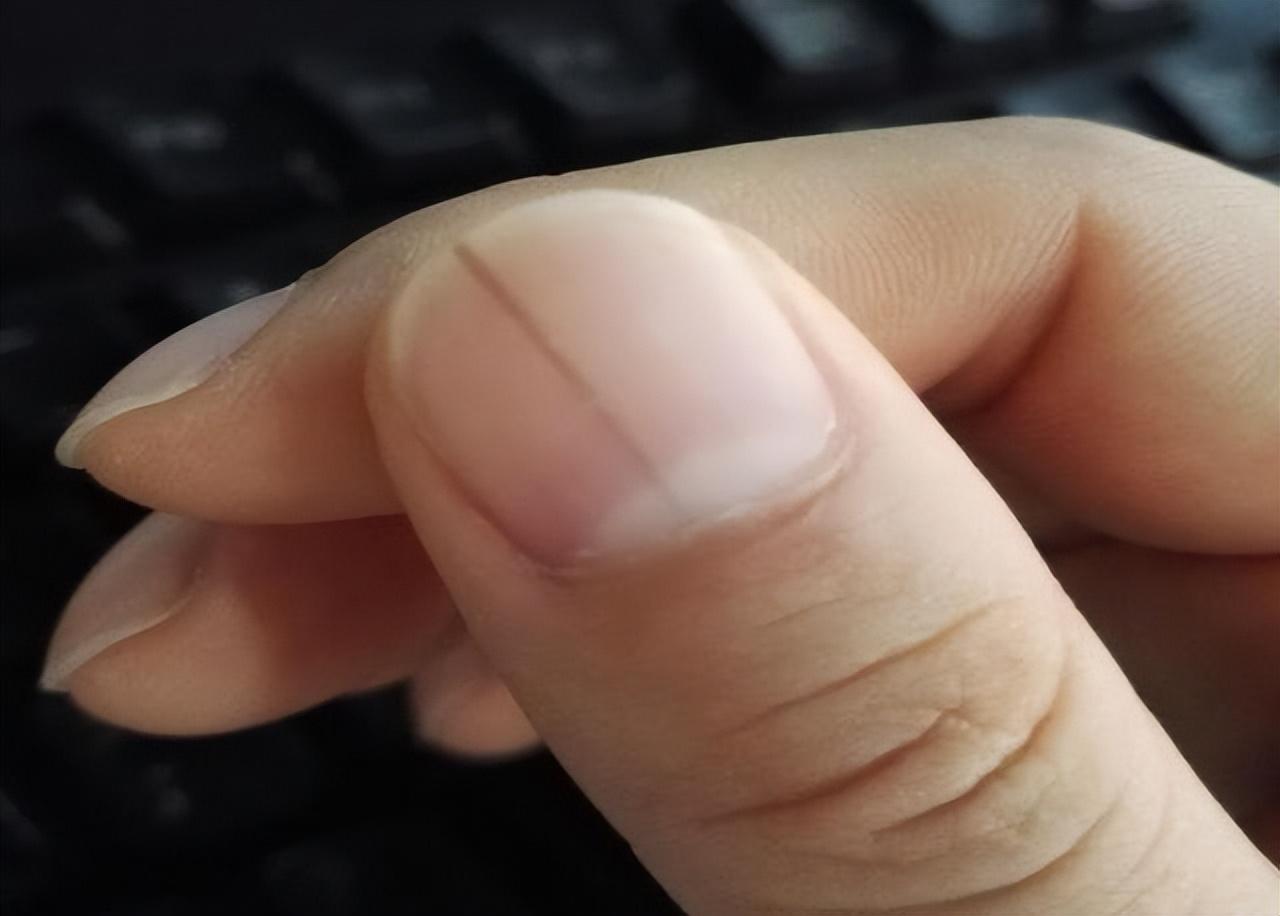 病毒肝补什么硒(补硒对肝病患者有好处吗)-硒宝网