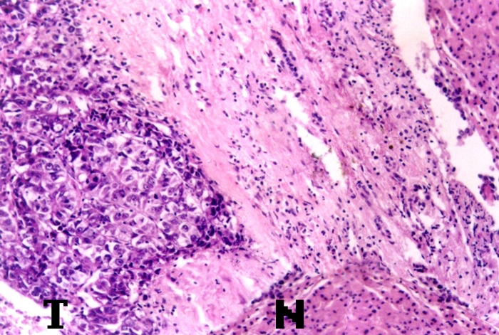 什么食物补硒多（食补补硒）-硒宝网
