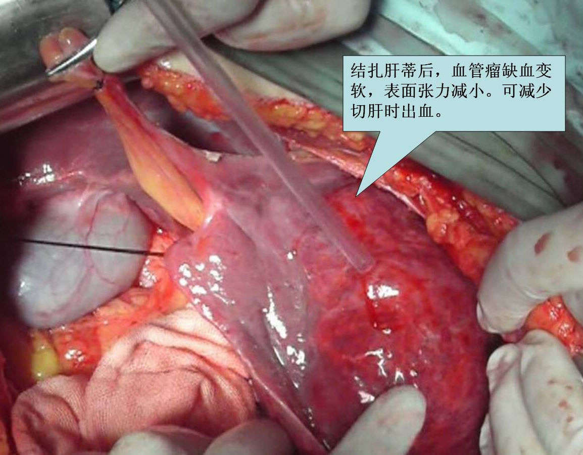 什么食物补硒多（食补补硒）-硒宝网