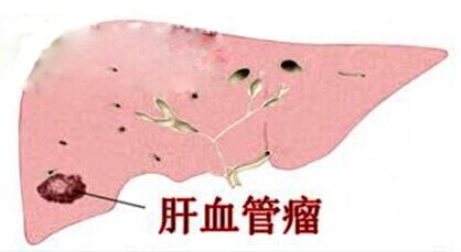 什么食物补硒多（食补补硒）-硒宝网