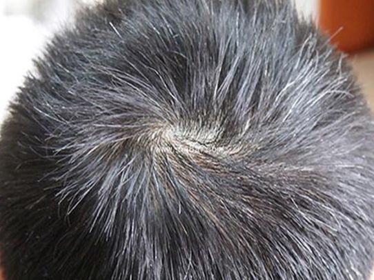 白头发是缺少什么微量元素(少白头不缺微量元素)-硒宝网