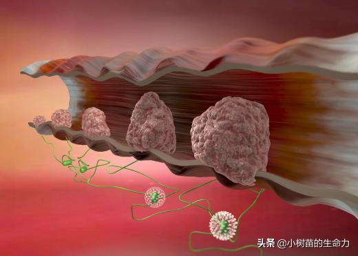 肠道息肉补硒吗（肠息肉吃硒酵母好吗）-硒宝网