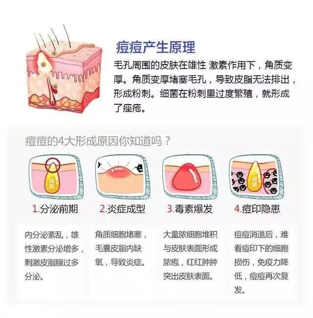 补锌可以祛痘吗(祛痘补锌可以补多久)-硒宝网