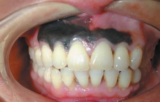 补硒会长头发吗(补硒能让白头发变黑吗)-硒宝网