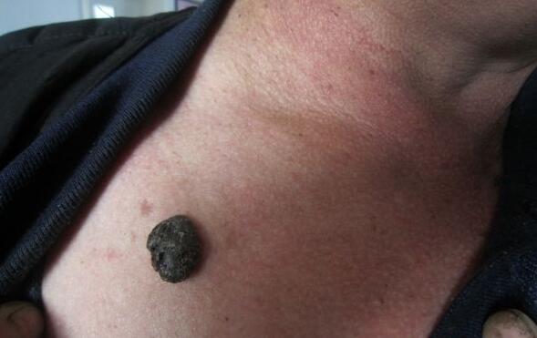 补硒会长头发吗(补硒能让白头发变黑吗)-硒宝网