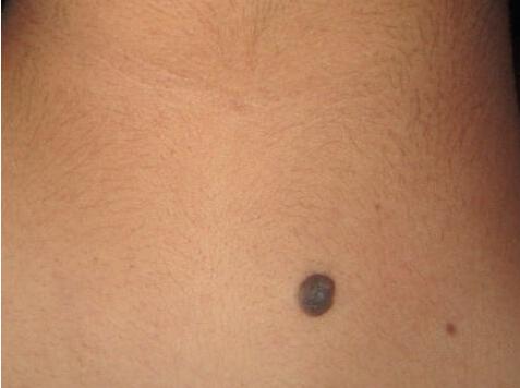 补硒会长头发吗(补硒能让白头发变黑吗)-硒宝网