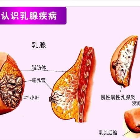补硒能去肺结节（肺部结节补硒）-硒宝网