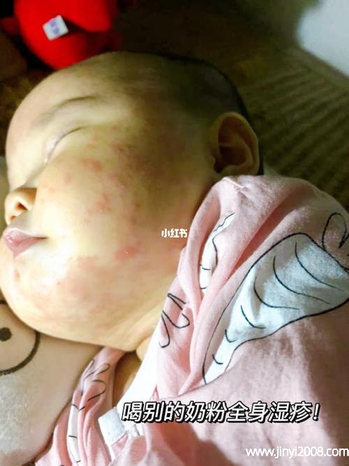 补硒皮肤会好吗(补硒对皮肤的好处)-硒宝网