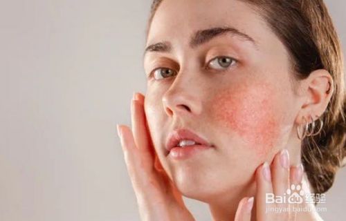 补硒皮肤会好吗(补硒对皮肤的好处)-硒宝网