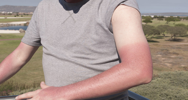 补硒皮肤会好吗(补硒对皮肤的好处)-硒宝网