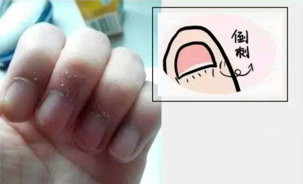 硒需要单独补吗（需要补充硒元素的人）-硒宝网