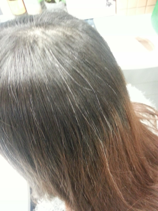 补硒能改善白发（白发能补改善硒元素吗）-硒宝网