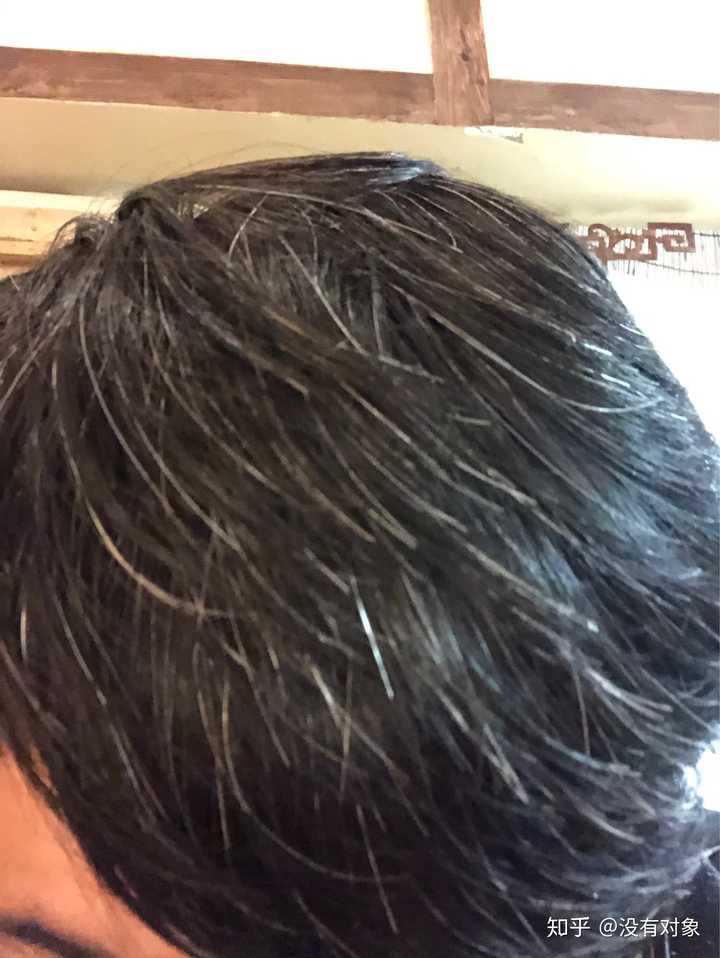 补硒能改善白发（白发能补改善硒元素吗）-硒宝网