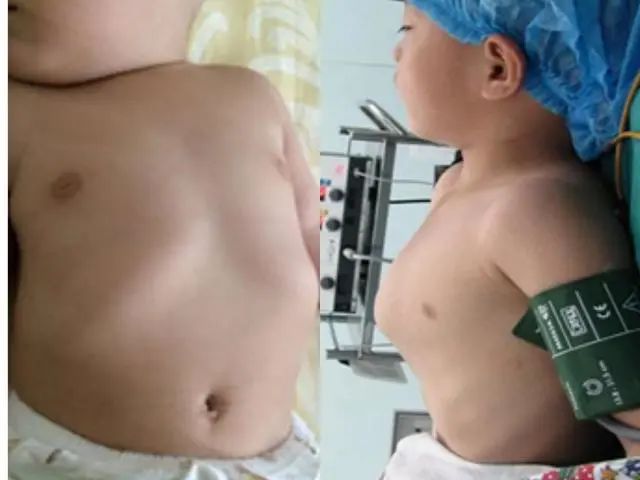 儿童补钙一年补几个月（娃儿补钙）-硒宝网