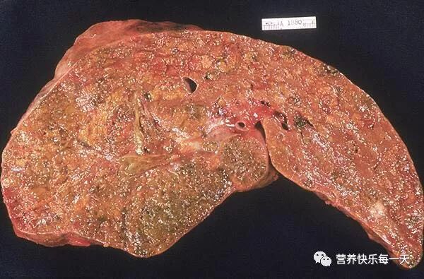 肝病补硒的方法(补肝病方法硒片有用吗)-硒宝网