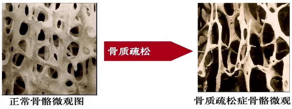 六十岁老人补钙哪一款好(补钙对老人好处)-硒宝网