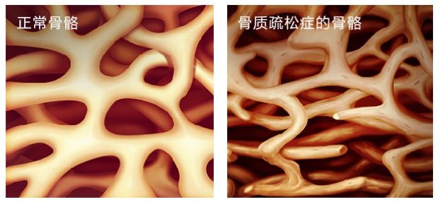 六十岁老人补钙哪一款好(补钙对老人好处)-硒宝网