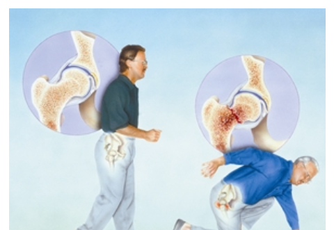 六十岁老人补钙哪一款好(补钙对老人好处)-硒宝网