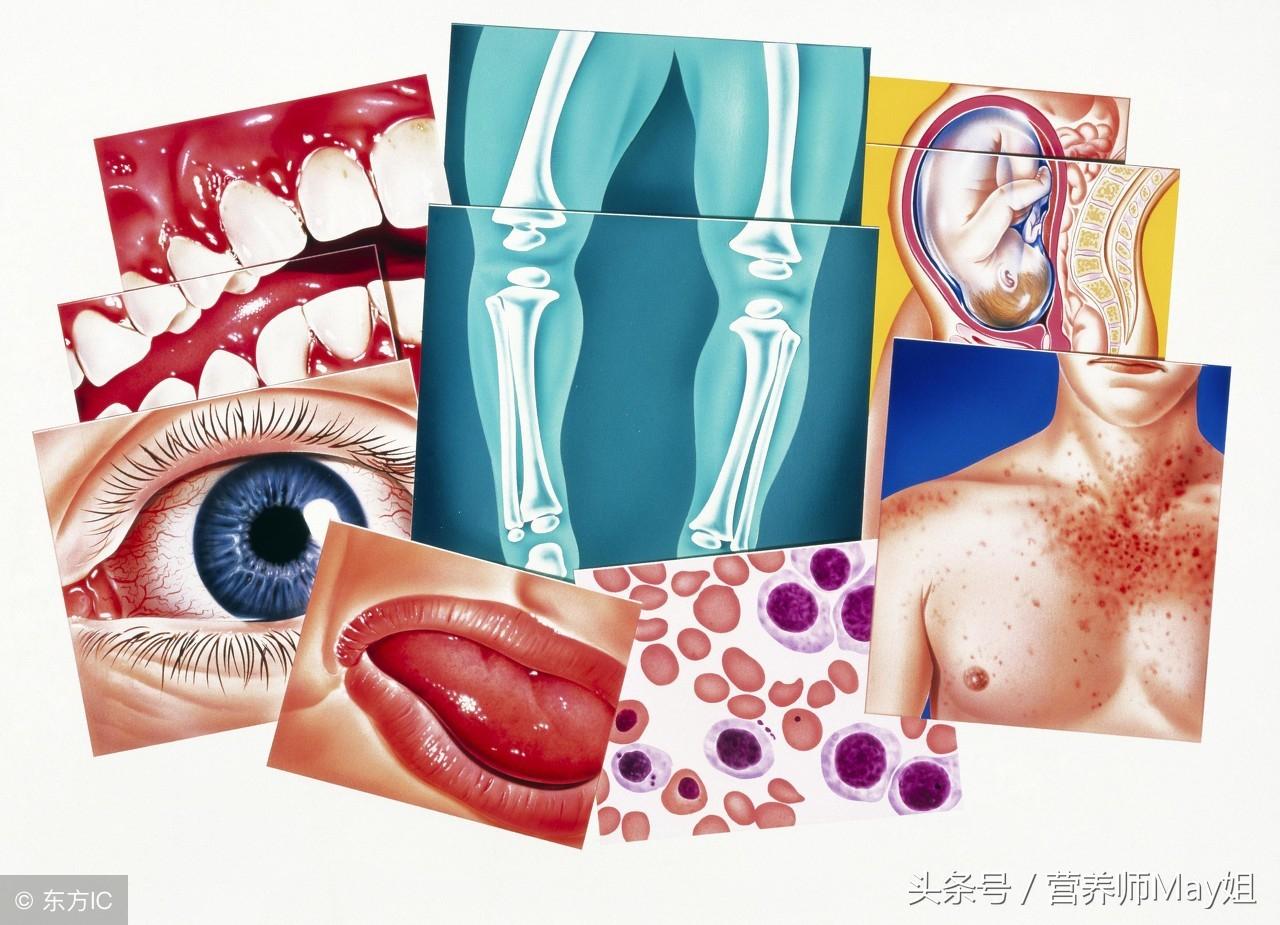什么东西补钙效果好(补钙效果好的是什么)-硒宝网