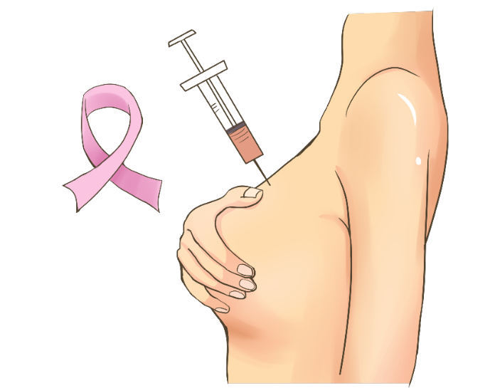 补硒能预防肺癌（补硒对肺癌有好处吗）-硒宝网