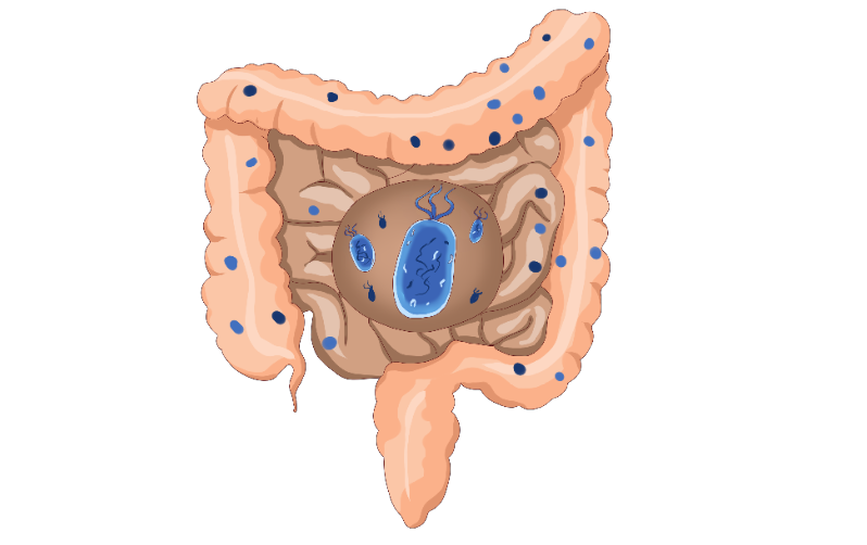 补硒能预防肺癌（补硒对肺癌有好处吗）-硒宝网
