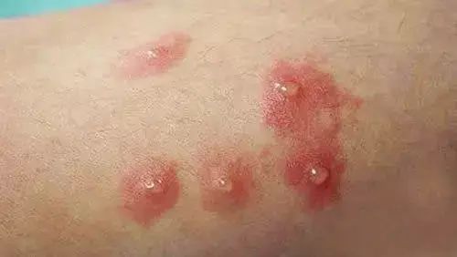 医生让补麦芽硒（麦芽硒补多了会有什么症状）-硒宝网