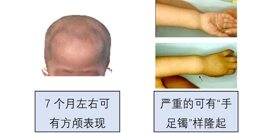 婴儿需要补锌吗(婴儿补锌需要补多久)-硒宝网