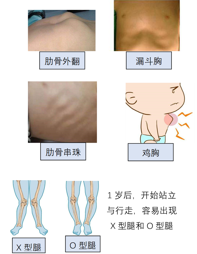 婴儿需要补锌吗(婴儿补锌需要补多久)-硒宝网