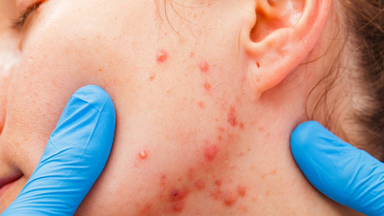 补硒对人体健康(人体补健康硒有用吗)-硒宝网