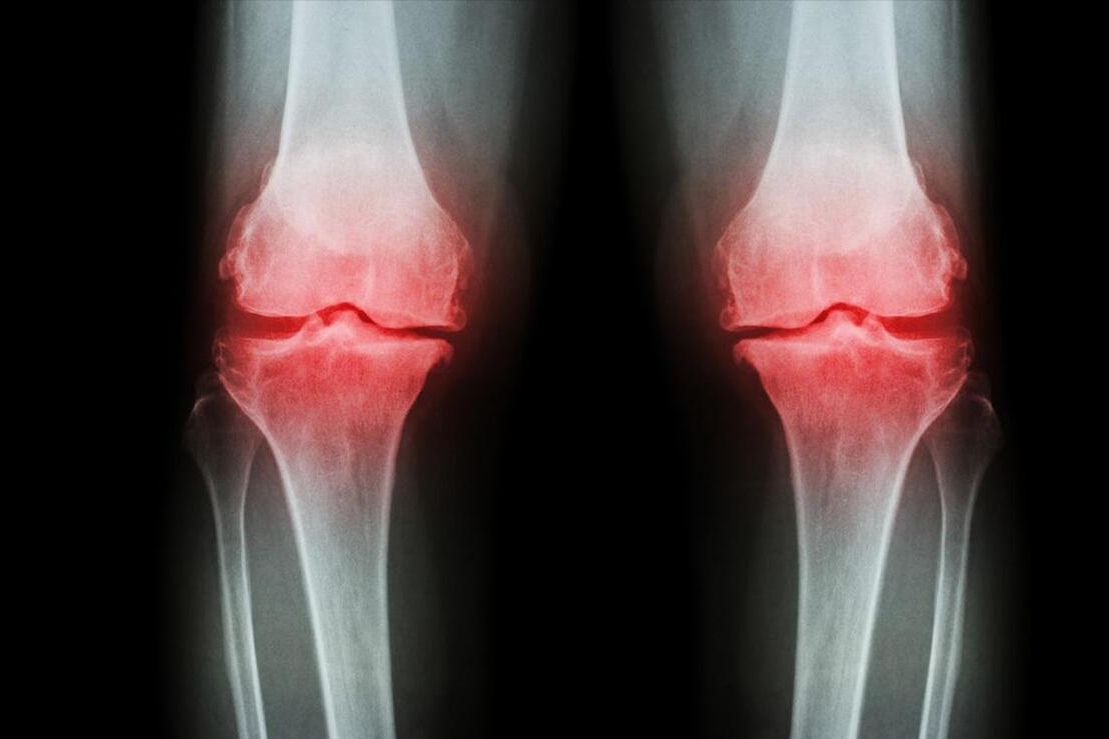 硒可以长期补吗(硒要长期补一直补)-硒宝网