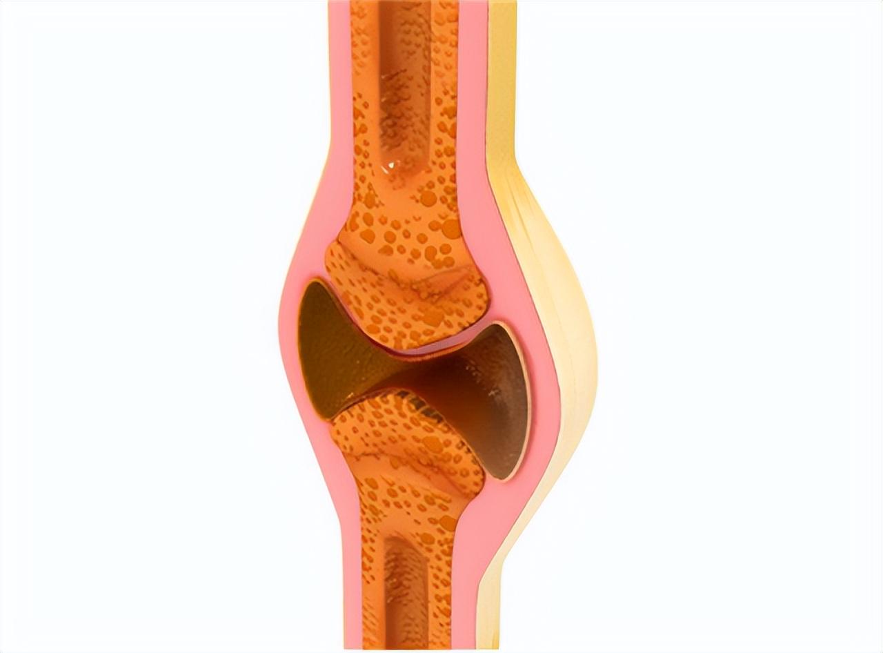 硒可以长期补吗(硒要长期补一直补)-硒宝网