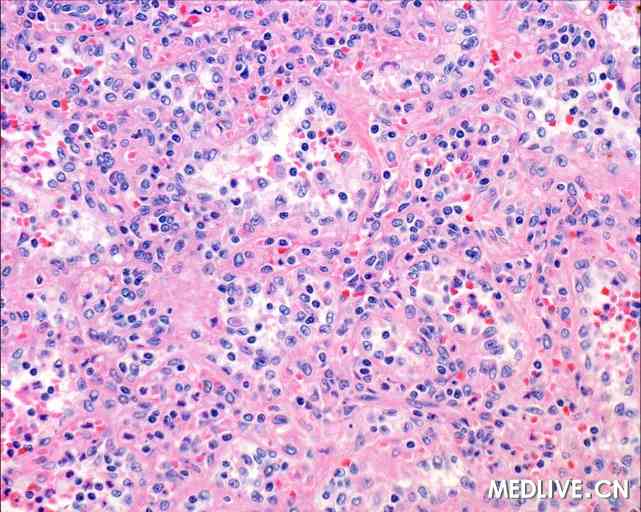 酵母补硒的功效(酵母硒有副作用吗)-硒宝网