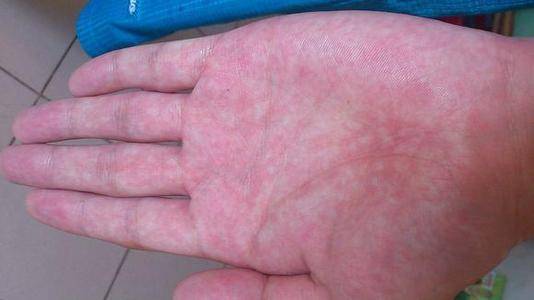 肝不好补什么硒（补硒肝脏）-硒宝网