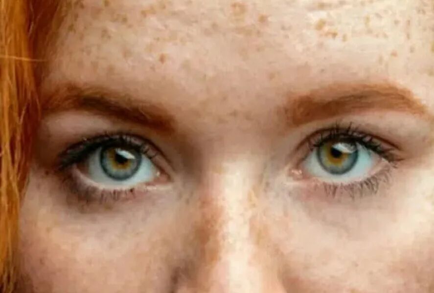 补硒沙棘后腹泻（腹泻补沙棘硒后能吃吗）-硒宝网