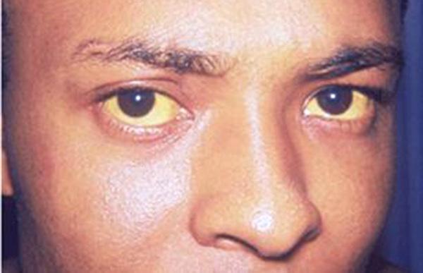 肝不好补什么硒(补硒对肝病有效吗)-硒宝网