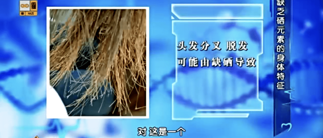 有机硒片补硒吗(片剂硒的缺馅)-硒宝网