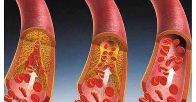 补硒导致高血压(高血压能吃硒吗)-硒宝网