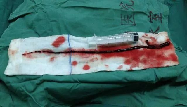 补硒后血压正常(血压补正常硒后会怎么样)-硒宝网