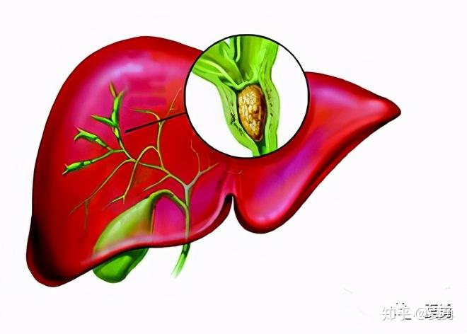 肝炎需要补硒冯(肝病需要补硒吗)-硒宝网