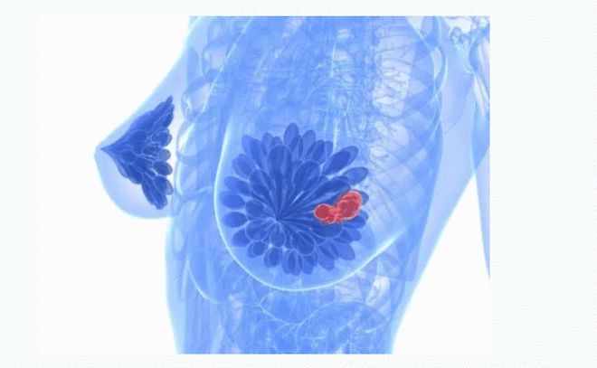 肠癌还能补硒吗(肠癌病人可以吃硒酵母吗)-硒宝网