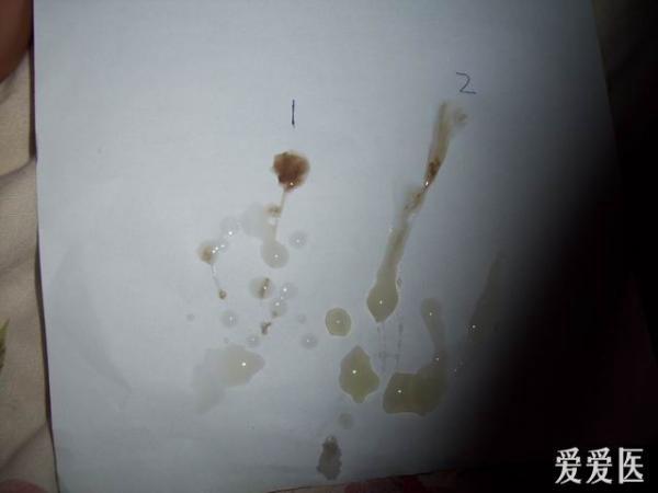 补硒会不会尿频(补硒会不会让尿酸高)-硒宝网