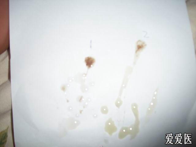 补硒会不会尿频(补硒会不会让尿酸高)-硒宝网