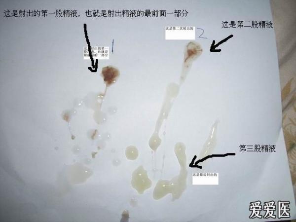 补硒会不会尿频(补硒会不会让尿酸高)-硒宝网