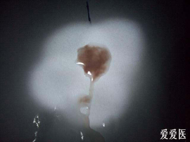 补硒会不会尿频(补硒会不会让尿酸高)-硒宝网