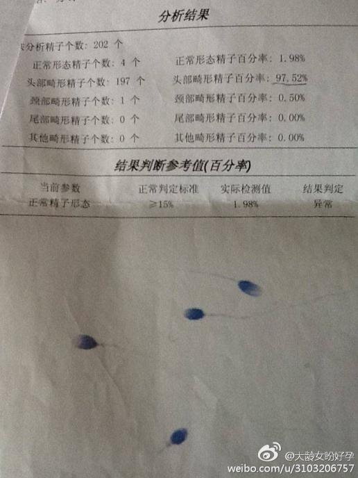 补硒会不会尿频(补硒会不会让尿酸高)-硒宝网