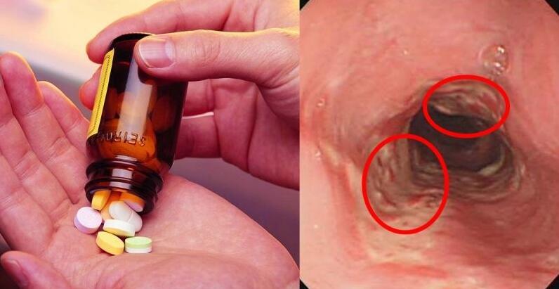 补硒的食物药品(补硒的药有害处吗)-硒宝网