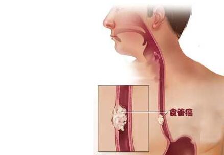 补硒的食物药品(补硒的药有害处吗)-硒宝网