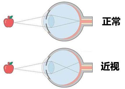 补硒后眼睛亮了(眼睛补亮硒后会反弹吗)-硒宝网