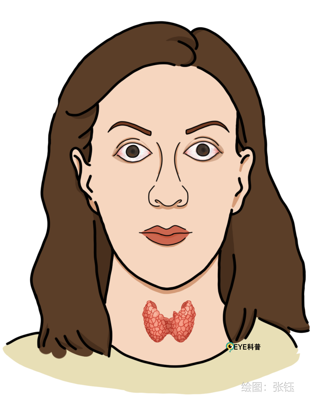 甲亢突眼 补硒（甲亢突眼为什么要吃硒酵母）-硒宝网