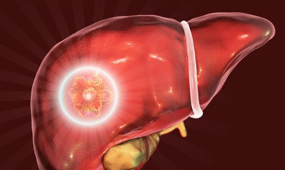 肝硬化补硒好吗（肝硬化补硒有没有效果）-硒宝网